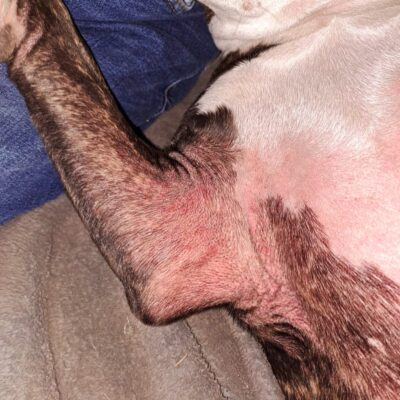 infection under armpits2